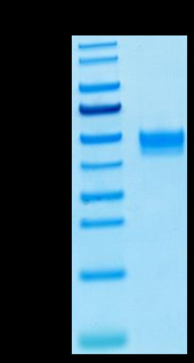 Human FGFR3 beta (IIIb) on Tris-Bis PAGE under reduced condition. The purity is greater than 95%.Recombinant Human FGFR3 beta (IIIb) Protein, Active