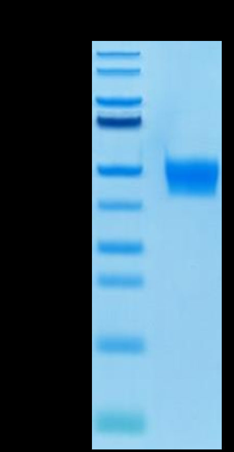 Biotinylated Human FGFR3 beta (IIIb) on Tris-Bis PAGE under reduced condition. The purity is greater than 95%.Biotinylated Human FGFR3 beta (IIIb) Protein, Active