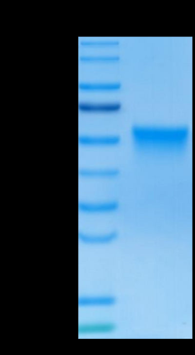 Human FGFR3 beta (IIIc) on Tris-Bis PAGE under reduced conditions. The purity is greater than 95%.Recombinant Human FGFR3 beta (IIIc) Protein, Active