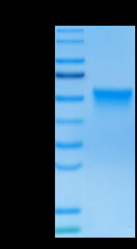 Human FGFR3 beta (IIIc) on Tris-Bis PAGE under reduced conditions. The purity is greater than 95%.Recombinant Human FGFR3 beta (IIIc) Protein, Active