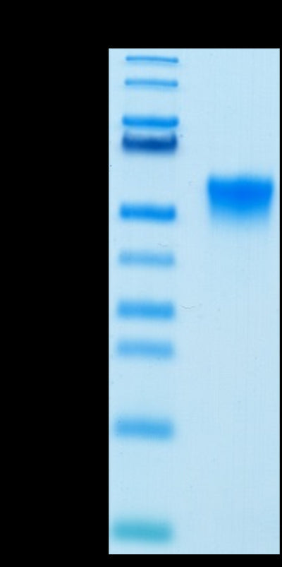 Biotinylated Human FGFR3 beta (IIIc) on Tris-Bis PAGE under reduced condition. The purity is greater than 95%.Biotinylated Human FGFR3 beta (IIIc) Protein, Active
