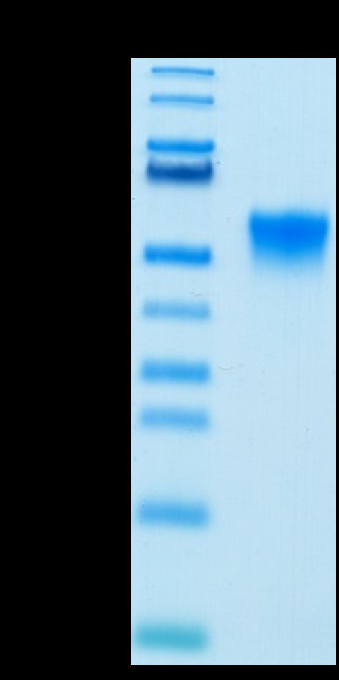 Biotinylated Human FGFR3 beta (IIIc) on Tris-Bis PAGE under reduced condition. The purity is greater than 95%.Biotinylated Human FGFR3 beta (IIIc) Protein, Active