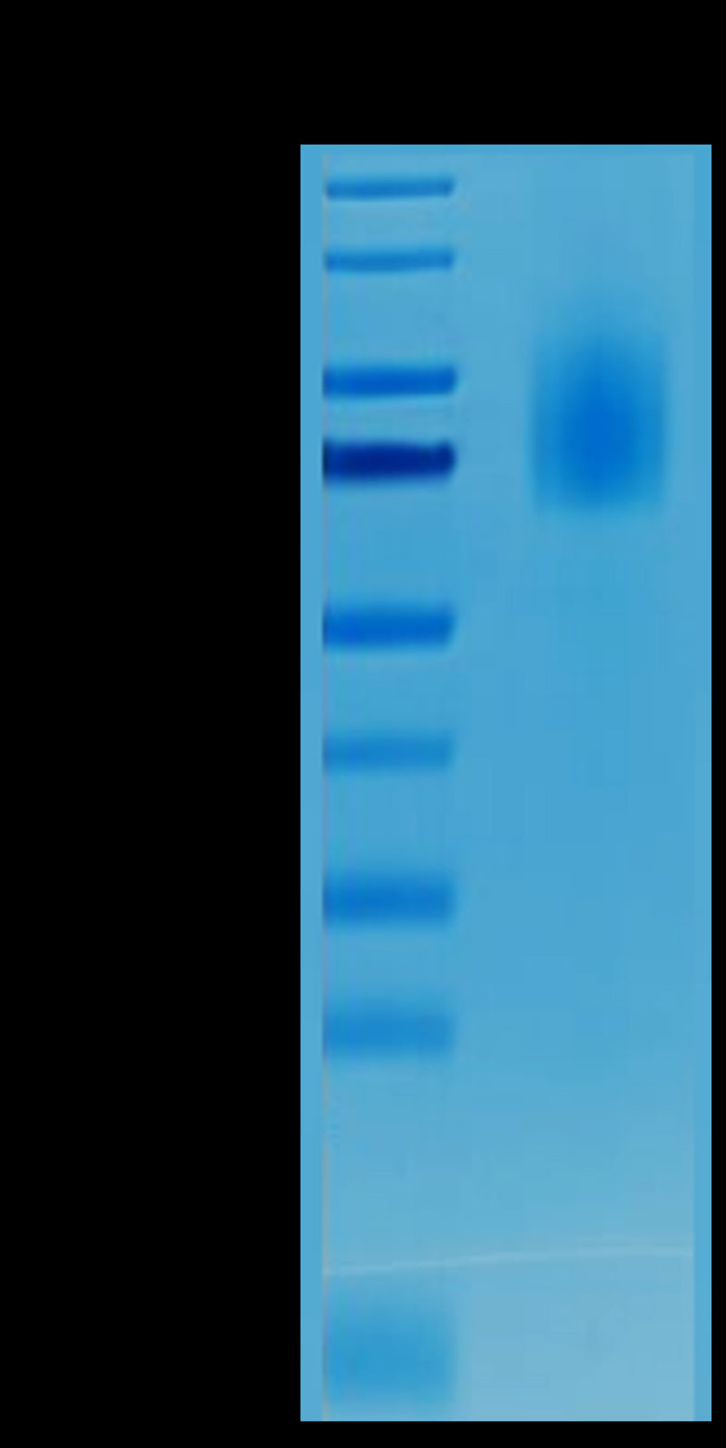 Biotinylated CD30 on Tris-Bis PAGE under reduced condition. The purity is greater than 95%.Biotinylated Human CD30/TNFRSF8 Protein, Active