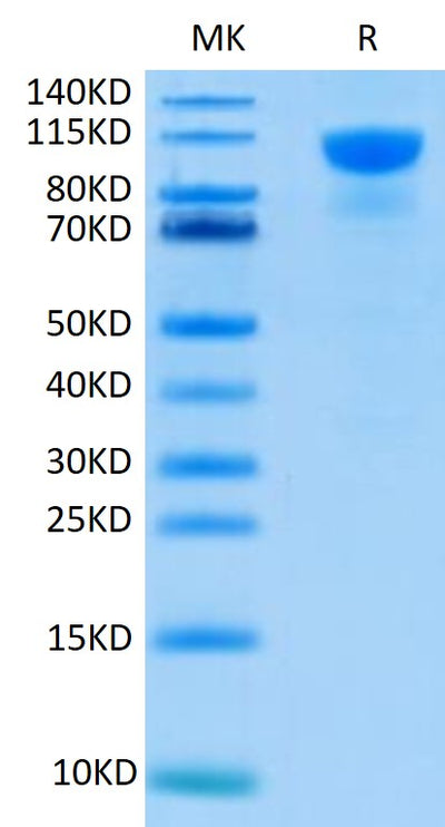 Human FGFR2 alpha (IIIb) on Tris-Bis PAGE under reduced condition. The purity is greater than 95%.Recombinant Human FGFR2 alpha (IIIb) Protein, Active