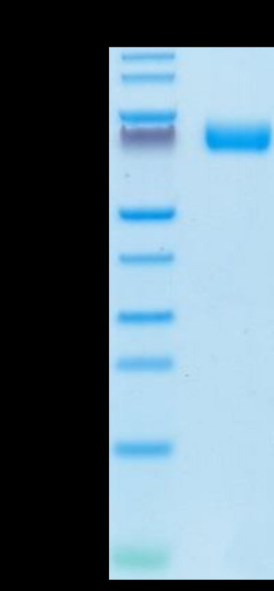 Human FGFR2 beta (IIIb) on Tris-Bis PAGE under reduced conditions. The purity is greater than 95%.Recombinant Human FGFR2 beta (IIIb) Protein, Active