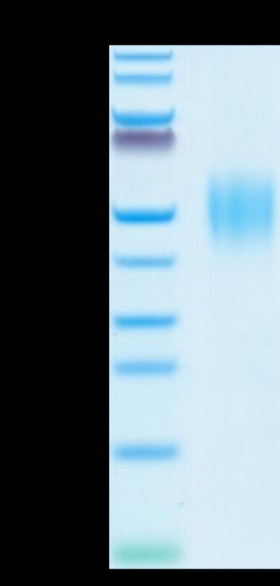 Human FGFR2 beta (IIIb) on Tris-Bis PAGE under reduced conditions. The purity is greater than 95%.Recombinant Human FGFR2 beta (IIIb) Protein, Active