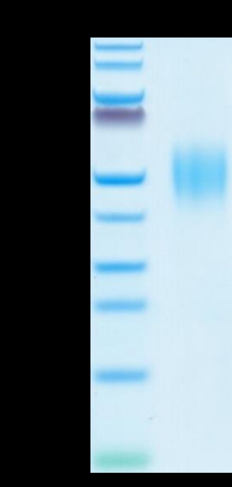 Human FGFR2 beta (IIIb) on Tris-Bis PAGE under reduced conditions. The purity is greater than 95%.Recombinant Human FGFR2 beta (IIIb) Protein, Active