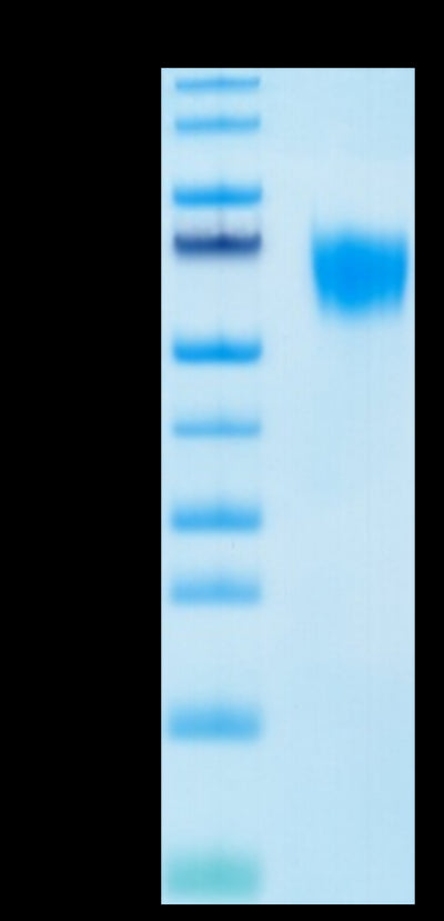 Biotinylated Human FGFR4 on Tris-Bis PAGE under reduced condition. The purity is greater than 95%.Biotinylated Human FGFR4 Protein