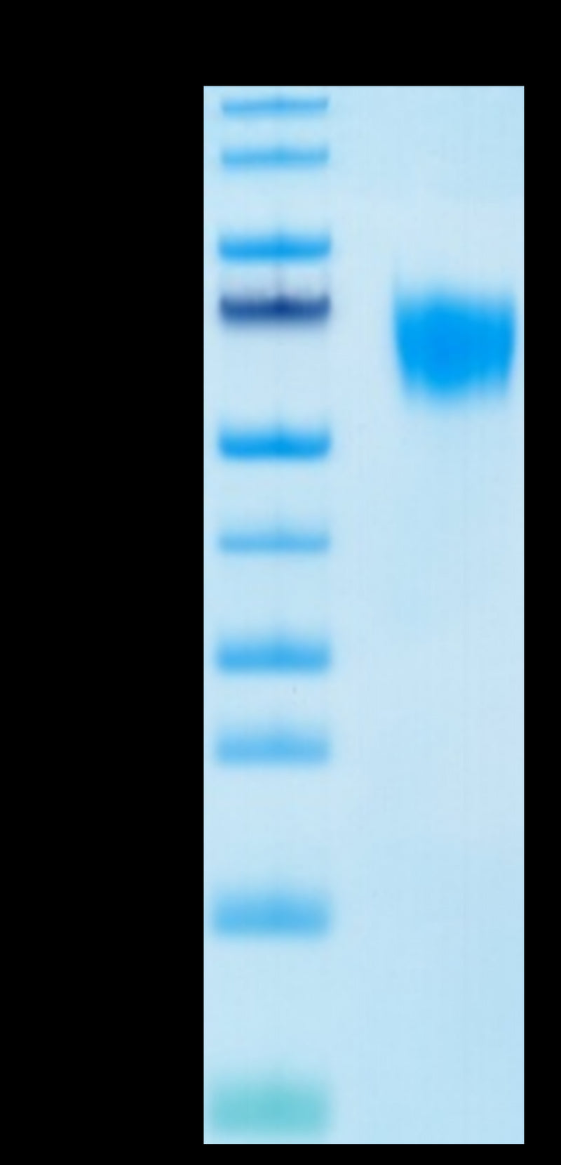 Biotinylated Human FGFR4 on Tris-Bis PAGE under reduced condition. The purity is greater than 95%.Biotinylated Human FGFR4 Protein