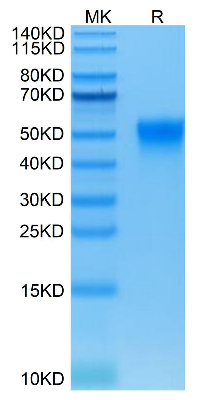 Biotinylated Human Fc gamma RIIIA (F176) on Tris-Bis PAGE under reduced condition. The purity is greater than 95%.Biotinylated Human Fc gamma RIIIA/CD16a (F176) Protein, Active