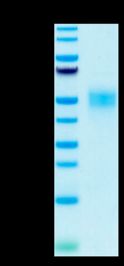 Biotinylated Human Fc gamma RIIIB (NA2) on Tris-Bis PAGE under reduced condition. The purity is greater than 95%.Biotinylated Human Fc gamma RIIIB/CD16b (NA2) Protein, Active