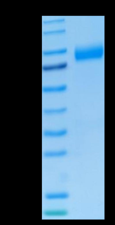 Human NKG2A&CD94 on Tris-Bis PAGE under reduced condition. The purity is greater than 95%.Recombinant Human NKG2A&CD94 Protein, Active