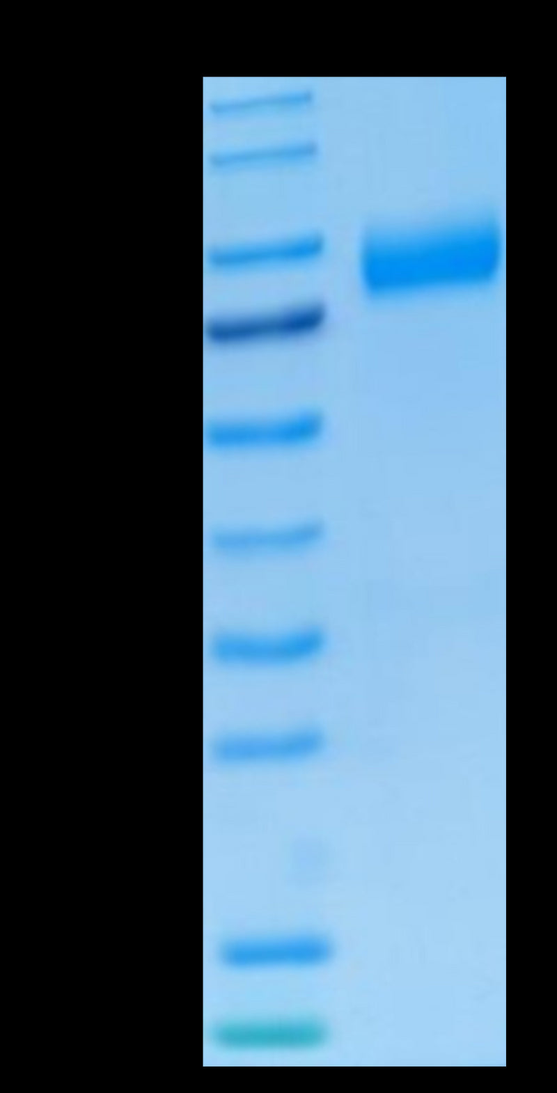 Human NKG2A&CD94 on Tris-Bis PAGE under reduced condition. The purity is greater than 95%.Recombinant Human NKG2A&CD94 Protein, Active