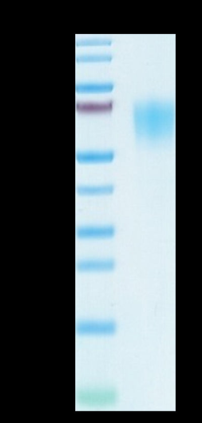 SARS-COV-2 Spike S1 NTD on Tris-Bis PAGE under reduced condition. The purity is greater than 95%.Recombinant SARS-COV-2 Spike S1 NTD Protein