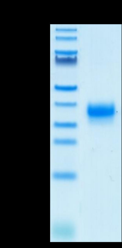 Human Fc gamma RIIA (H167) on Tris-Bis PAGE under reduced condition. The purity is greater than 95%.Biotinylated Human Fc gamma RIIA/CD32a (H167) Protein, Active