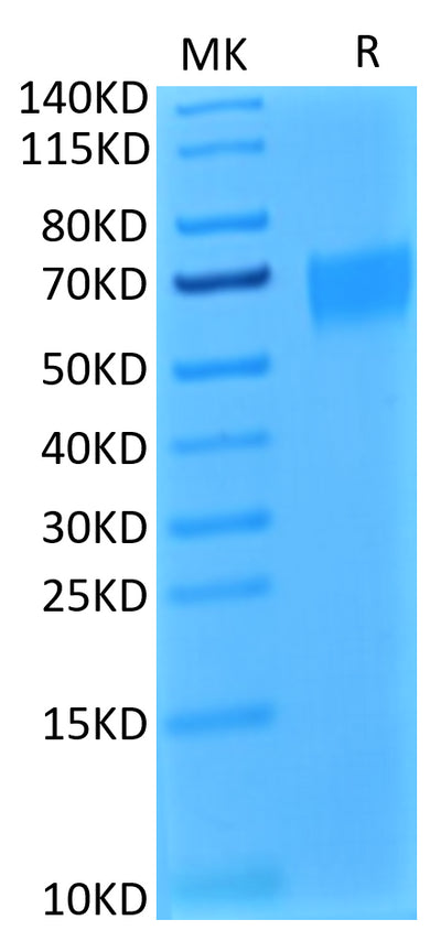 Biotinylated Human IL-17R alpha on Tris-Bis PAGE under reduced condition. The purity is greater than 95%.Biotinylated Human IL-17R alpha/CD217 Protein, Active