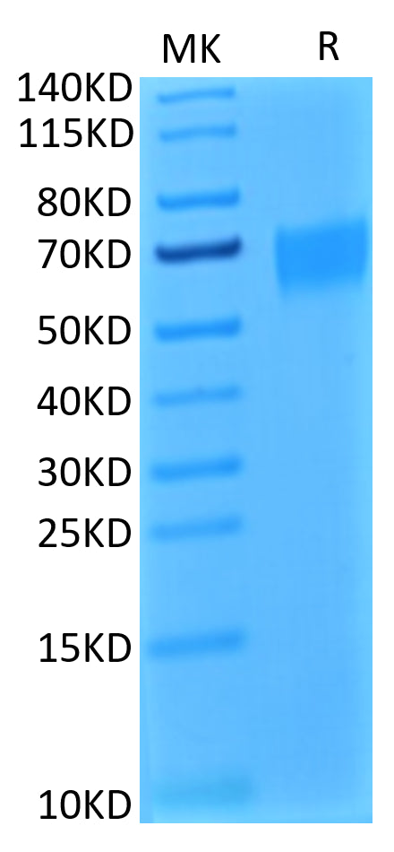 Biotinylated Human IL-17R alpha on Tris-Bis PAGE under reduced condition. The purity is greater than 95%.Biotinylated Human IL-17R alpha/CD217 Protein, Active