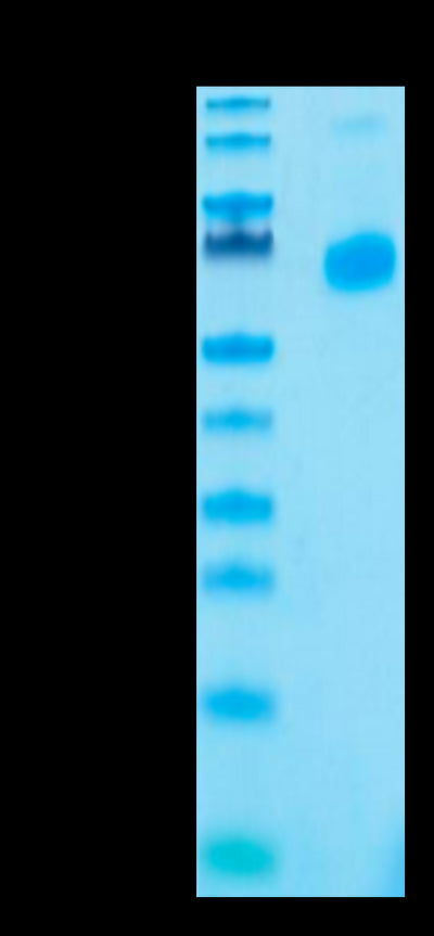 Human CD27 Ligand Trimer on Tris-Bis PAGE under reduced condition. The purity is greater than 95%.Recombinant Human CD27 Ligand/CD70 Trimer Protein, Active