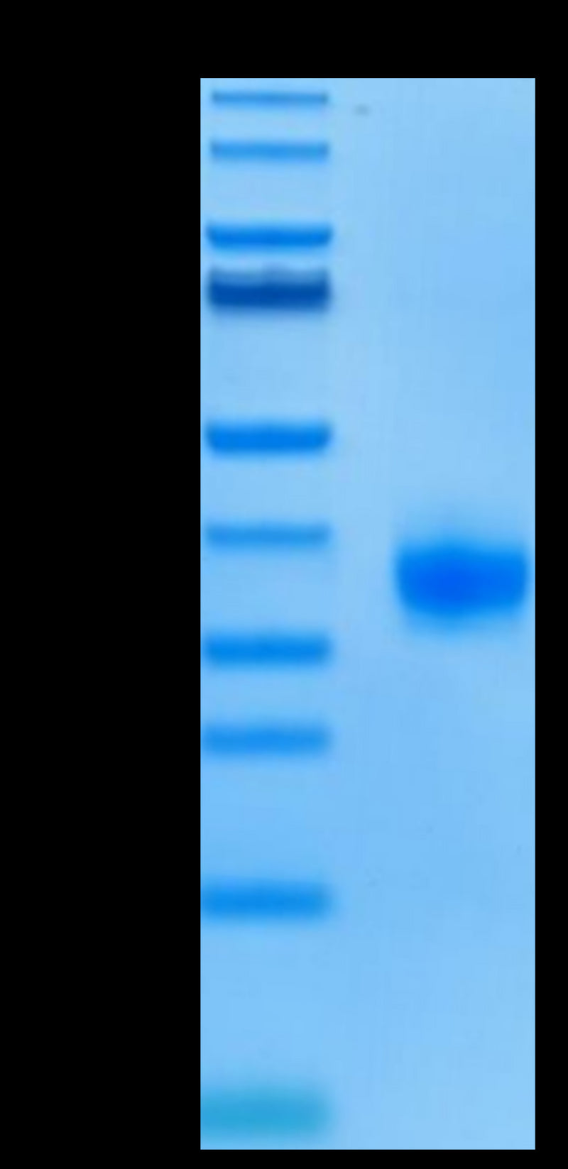 Biotinylated Human ULBP-2 on Tris-Bis PAGE under reduced condition. The purity is greater than 95%.Biotinylated Human ULBP-2 Protein, Active