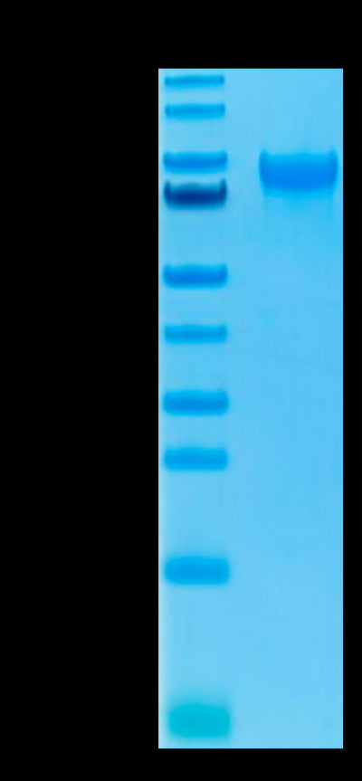 Human IL-15RA on Tris-Bis PAGE under reduced condition. The purity is greater than 95%.Recombinant Human IL-15RA/IL-15 R alpha/CD215 Protein, Active