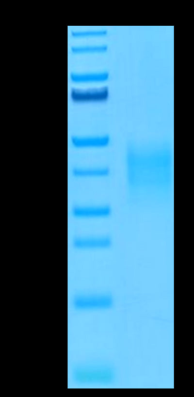 Human TRAIL R4 on Tris-Bis PAGE under reduced conditions. The purity is greater than 95%.Recombinant Human TRAIL R4/TNFRSF10D Protein, Active