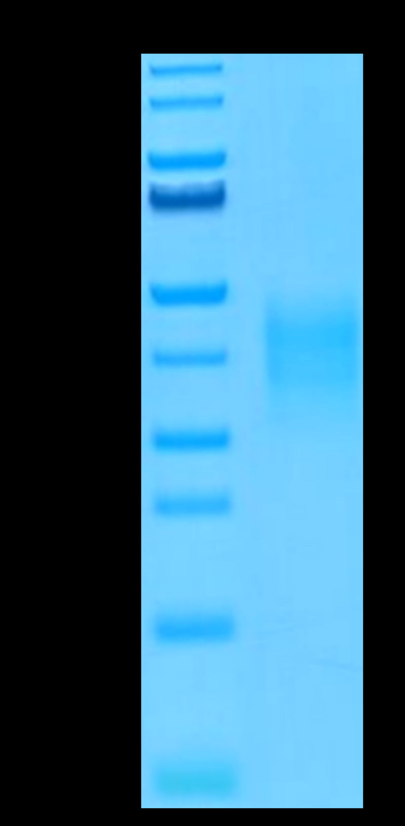 Human TRAIL R4 on Tris-Bis PAGE under reduced conditions. The purity is greater than 95%.Recombinant Human TRAIL R4/TNFRSF10D Protein, Active