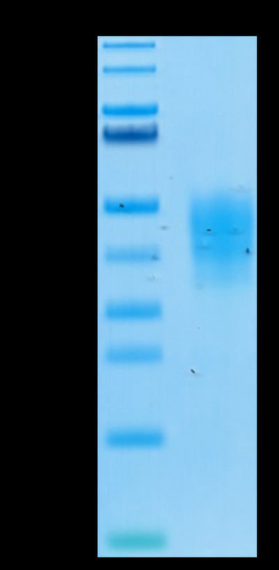 Biotinylated Human TRAIL R4 on Tris-Bis PAGE under reduced conditions. The purity is greater than 95%.Biotinylated Human TRAIL R4/TNFRSF10D Protein, Active