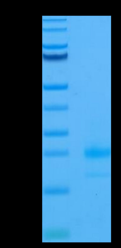 Human TRAIL R1 on Tris-Bis PAGE under reduced conditions. The purity is greater than 95%.Recombinant Human TRAIL R1/DR4/TNFRSF10A Protein, Active