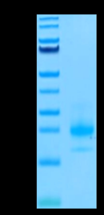Biotinylated Human TRAIL R1 on Tris-Bis PAGE under reduced conditions. The purity is greater than 95%.Biotinylated Human TRAIL R1/DR4/TNFRSF10A Protein, Active
