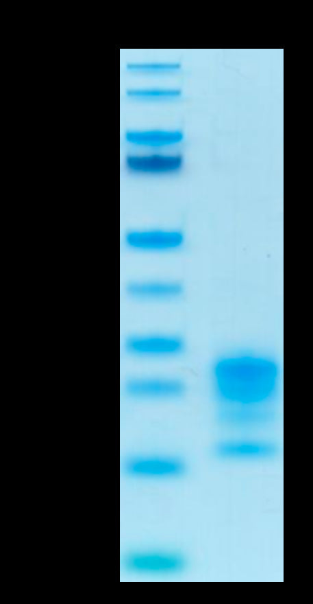 Biotinylated Human IL-17A on Tris-Bis PAGE under reduced condition. The purity is greater than 95%.Biotinylated Human IL-17A/CTLA-8 Protein, Active