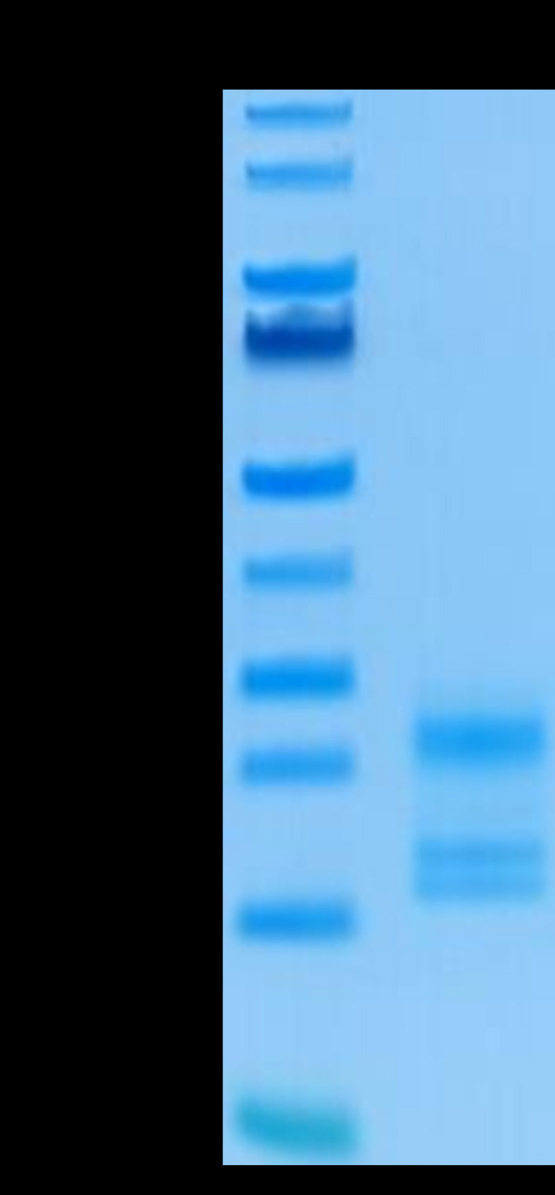 Human IL-17A on Tris-Bis PAGE under reduced condition. The purity is greater than 95%.Recombinant Human IL-17A/CTLA-8 Protein, Active