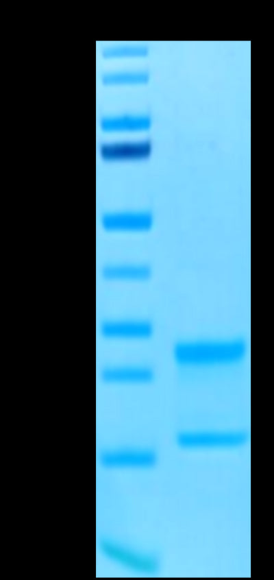 Biotinylated Human IL-17A&F on Tris-Bis PAGE under reduced conditions. The purity is greater than 95%.Biotinylated Human IL-17A&F Protein, Active