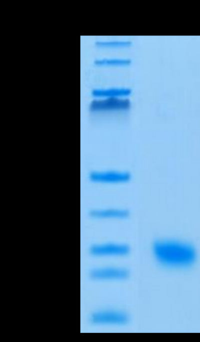 Human IL-17F on Tris-Bis PAGE under reduced condition. The purity is greater than 95%.Recombinant Human IL-17F Protein, Active