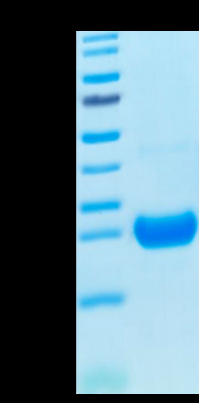 Cynomolgus IL-17F on Tris-Bis PAGE under reduced condition. The purity is greater than 95%.Recombinant Cynomolgus IL-17F Protein, Active
