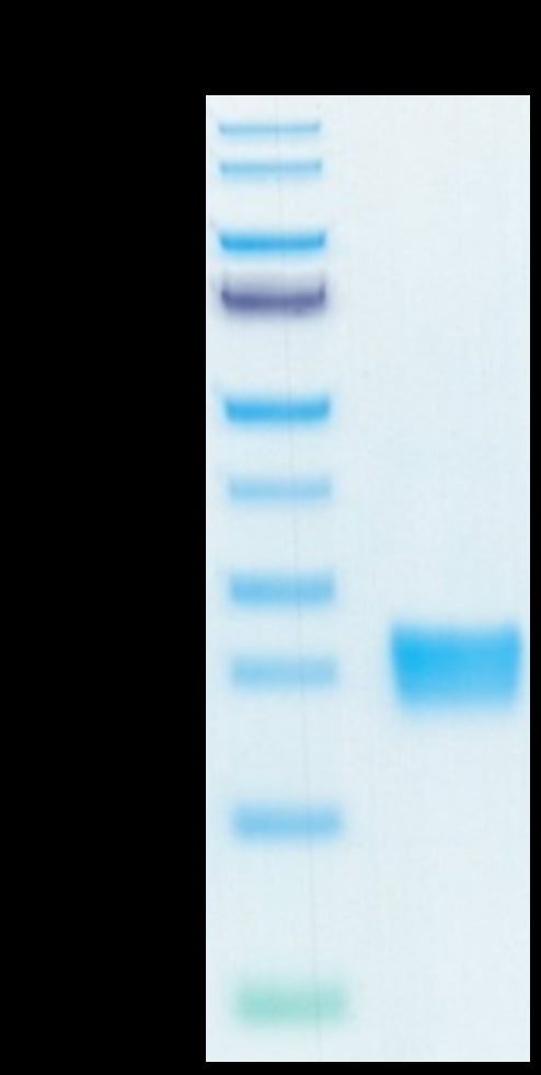 Biotinylated Human IL-17F on Tris-Bis PAGE under reduced condition. The purity is greater than 95%.Biotinylated Human IL-17F Protein, Active