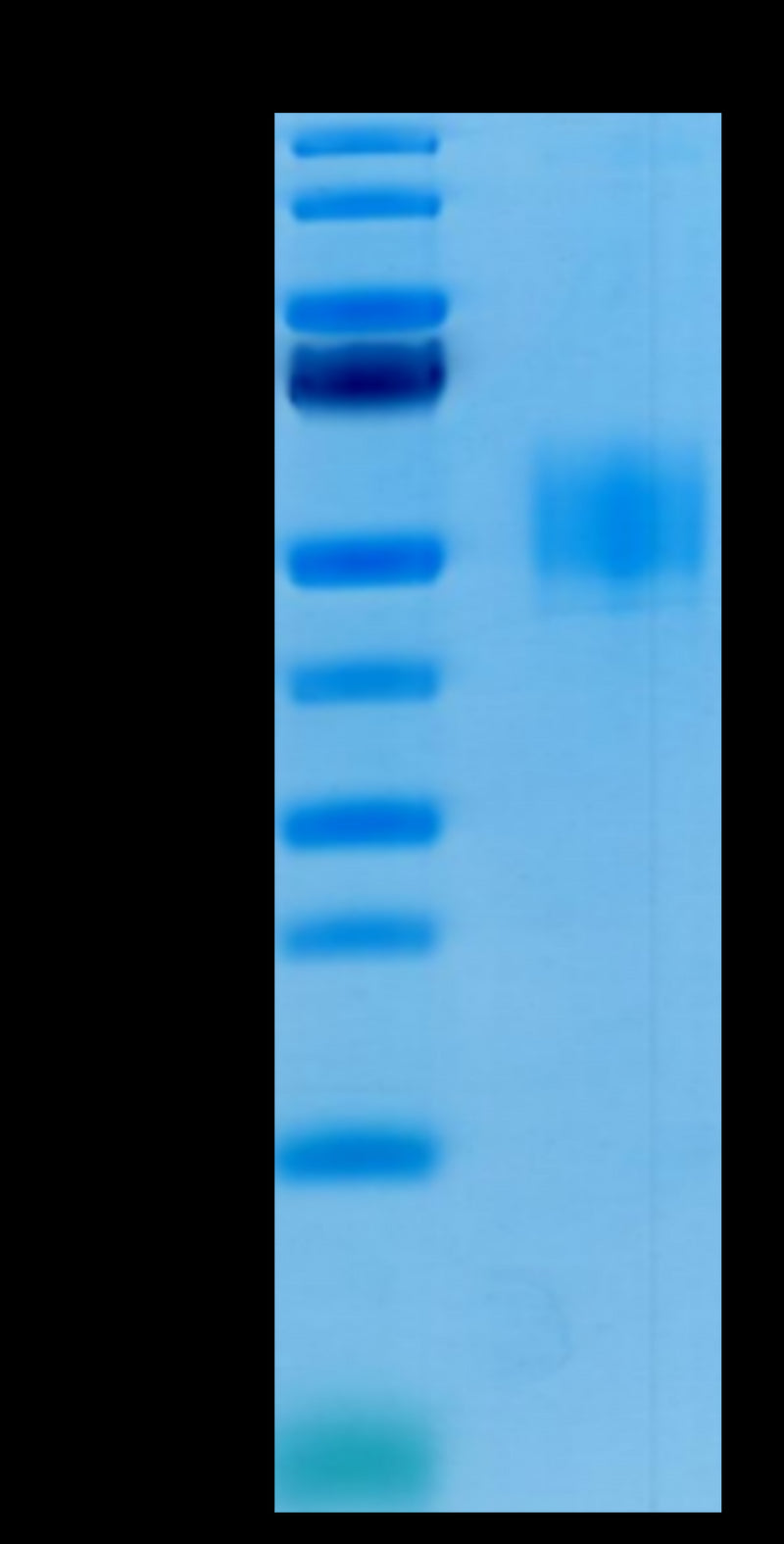 Human GFRAL on Tris-Bis PAGE under reduced condition.The purity is greater than 95%.Recombinant Human GFRAL/GFR alpha-like Protein, Active