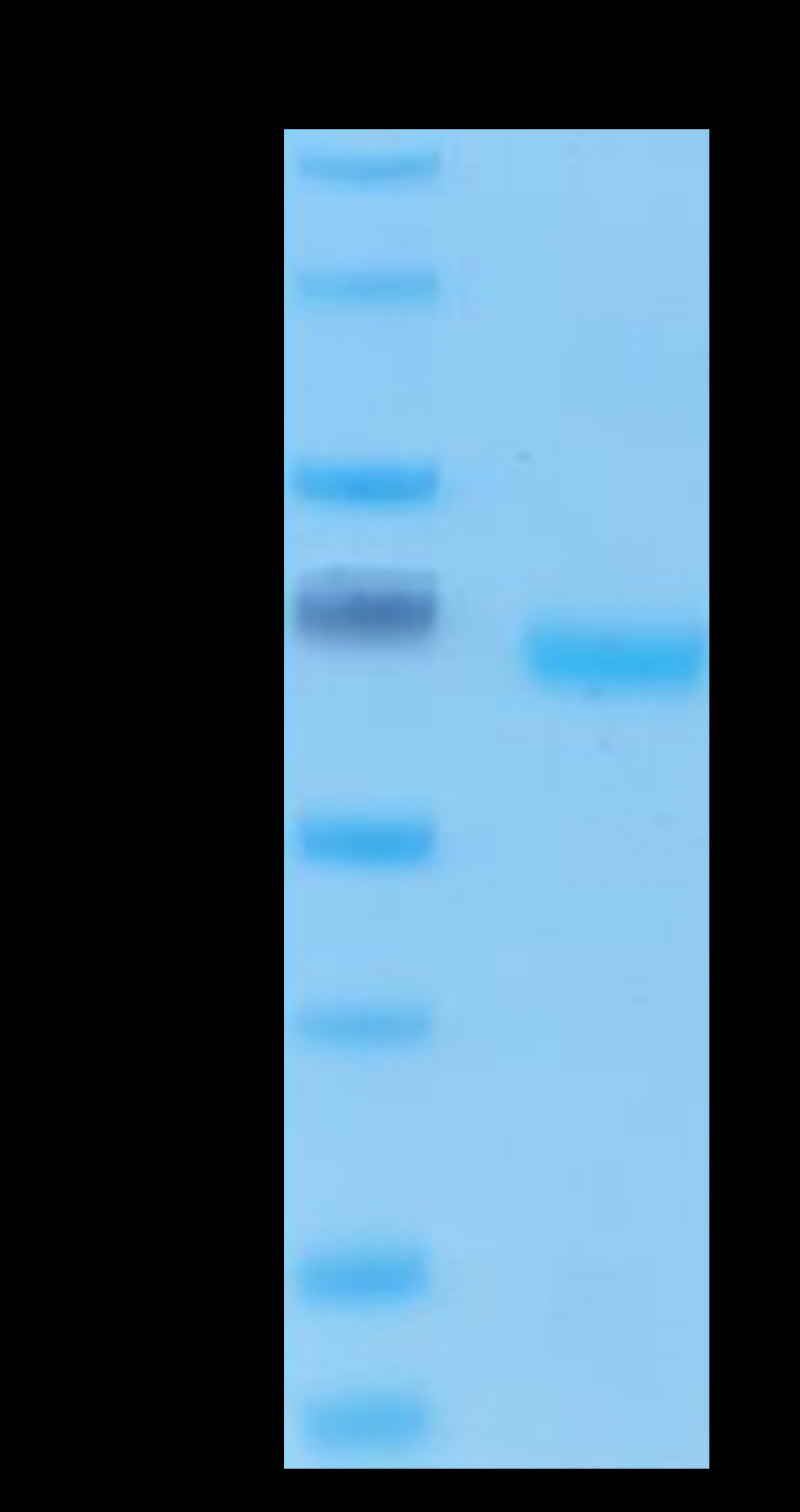 Human EpCAM on Tris-Bis PAGE under reduced condition. The purity is greater than 95%..Recombinant Human EpCAM/TROP1 Protein, Active