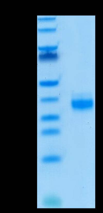 Biotinylated Human EpCAM on Tris-Bis PAGE under reduced condition. The purity is greater than 95%..Biotinylated Human EpCAM/TROP1 Protein, Active