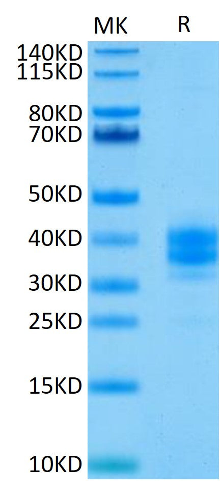 Human EpCAM on Tris-Bis PAGE under reduced condition. The purity is greater than 95%..Recombinant Human EpCAM/TROP1 Protein, Active