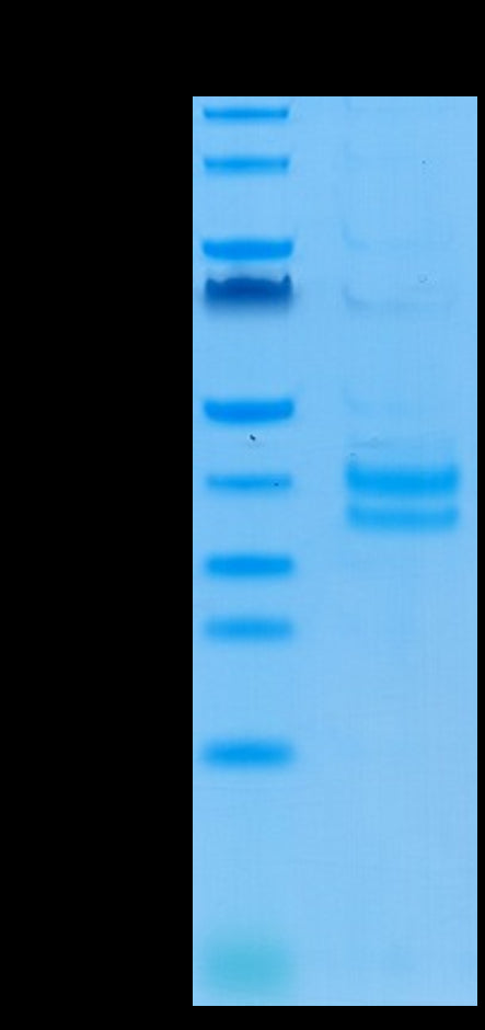 Cynomolgus/Rhesus macaque EpCAM on Tris-Bis PAGE under reduced condition. The purity is greater than 95%.Recombinant Cynomolgus/Rhesus macaque EpCAM/TROP1 Protein, Active