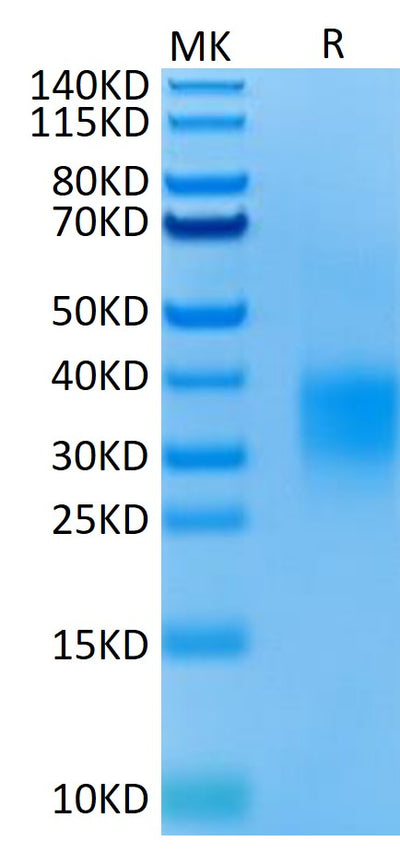 Mouse GITR on Tris-Bis PAGE under reduced condition. The purity is greater than 95%.Recombinant Mouse GITR/TNFRSF18 Protein