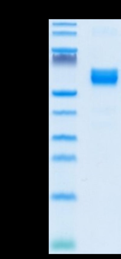 Human NKG2A on Tris-Bis PAGE under reduced condition. The purity is greater than 95%.Recombinant Human NKG2A/CD159a Protein, Active