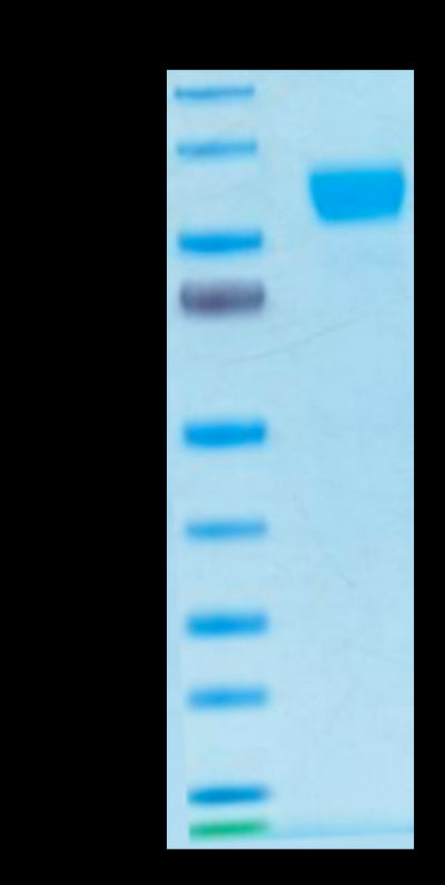 Biotinylated Human Her2 on Tris-Bis PAGE under reduced condition. The purity is greater than 95%.Biotinylated Human Her2/ErbB2 Protein, Active