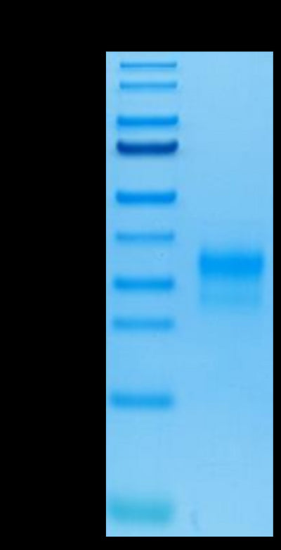 Human Her2 Domain 4 on Tris-Bis PAGE under reduced condition. The purity is greater than 95%.