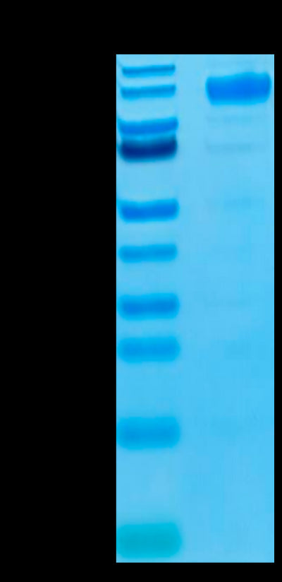Biotinylated Human VEGF R1 on Tris-Bis PAGE under reduced condition. The purity is greater than 95%.Biotinylated Human VEGF R1/FLT-1 Protein, Active