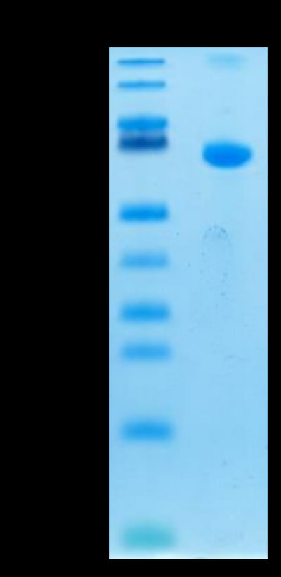 Human TSLPR on Tris-Bis PAGE under reduced condition. The purity is greater than 95%.Recombinant Human TSLPR Protein, Active
