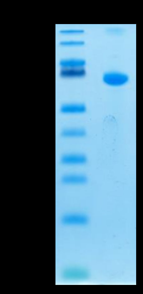 Human TSLPR on Tris-Bis PAGE under reduced condition. The purity is greater than 95%.Recombinant Human TSLPR Protein, Active