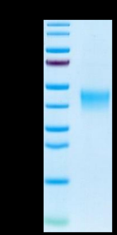 Human TSLPR on Tris-Bis PAGE under reduced condition. The purity is greater than 95%.Recombinant Human TSLPR Protein, Active