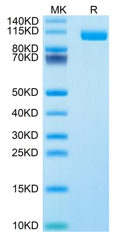 Biotinylated Human Siglec-10 on Tris-Bis PAGE under reduced condition. The purity is greater than 95%.Biotinylated Human Siglec-10 Protein, Active