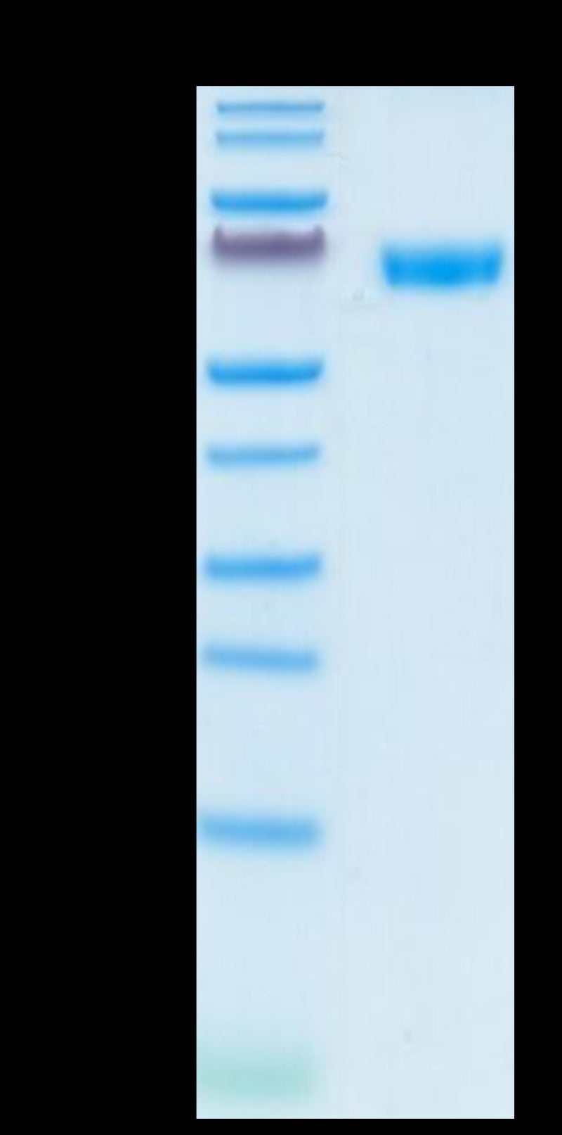 Human CD200 on Tris-Bis PAGE under reduced condition. The purity is greater than 95%.Recombinant Human CD200/OX-2 Protein, Active